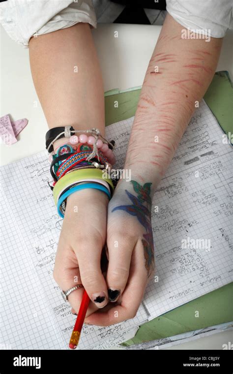Image Of Self Harm Cuts To The Arm Stock Photo Alamy