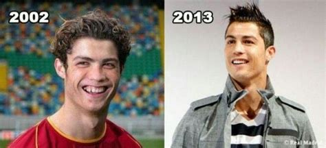 Cristiano has transformed himself with different plastic surgeries in which teeth implants is the most controversial surgery. Épinglé par Muriel Demortier sur avant après | Avant après