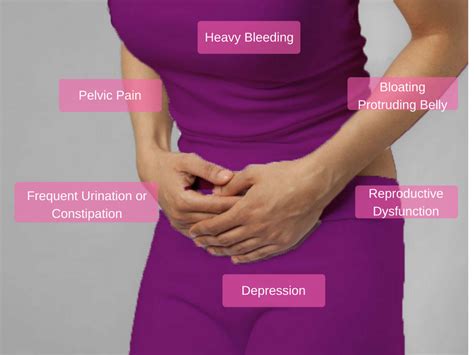All You Need To Know About Fibroids Symptoms Treatment Diagnosis
