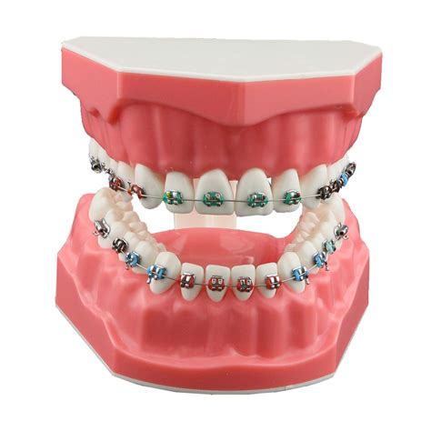 Dentalmall Dental Orthodontic Brackets Model With Molar Tubesligature Ties Typodonts Practice