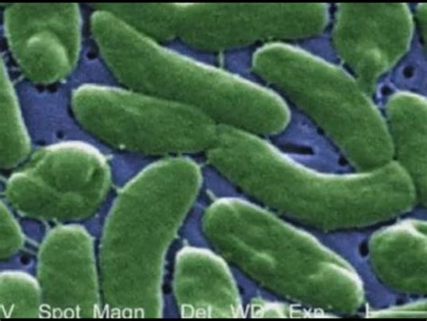 2 Cases Of Flesh Eating Bacteria Confirmed In Sarasota County