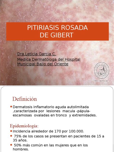 Pitiriasis Rosada Pdf Rtt Especialidades Medicas