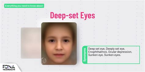 What Causes Deep Set Eyes Symptoms Of A Rare Disease