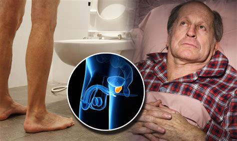 Prostate Cancer Seven Symptoms Of The Disease Revealed Health Life And Style Uk