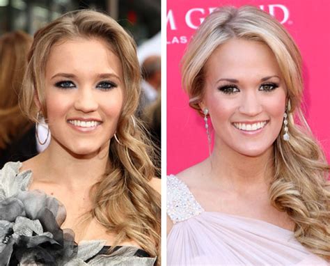 Celebrity Carrie Underwood Plastic Surgery Photos Video