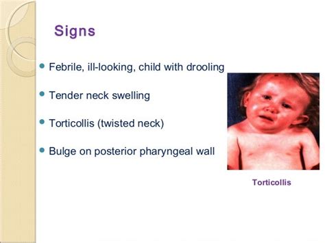 Deep Neck Infection