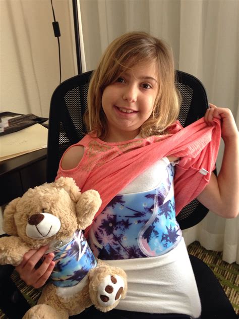 How Happy Is She She Just Loves Her Higgy Bear Scoliosis Brace