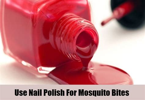 Can You Put Clear Nail Polish On Bug Bites