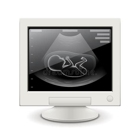 conceito da composição do ultrassom da gravidez mulher gravida com doutor ilustração do vetor