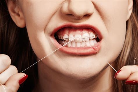 How to floss with braces. BracesLasVegas Orthodontics Blog