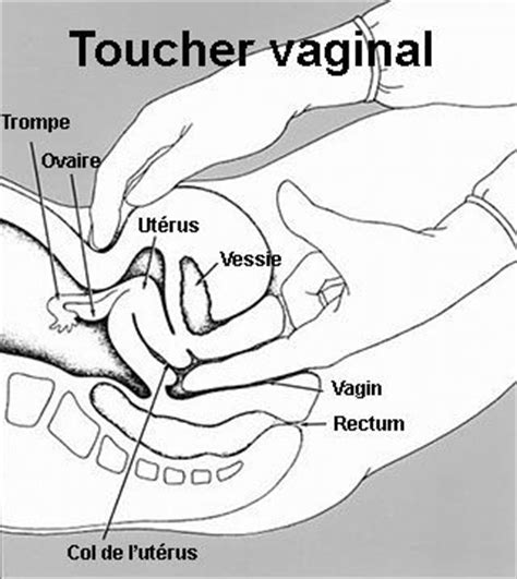 Le Toucher Vaginal Doit Il Tre Syst Matique Oummi Materne Le