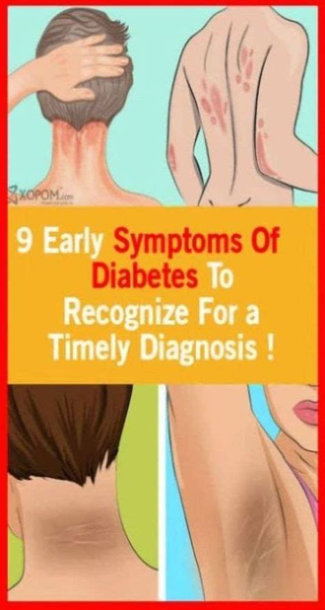 Symptoms Of Early Diabetes To Recognize For A Timely Diagnosis