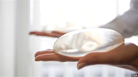 FDA Alerts More Doctors Of Rare Cancer With Breast Implants