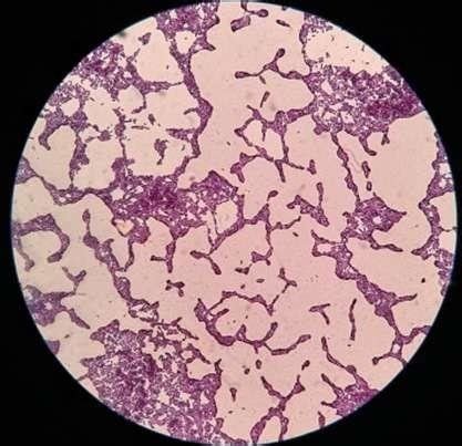 They are actually heavily composed of connective. Gram staining of Bacillus amyloliquefaciens strain UB-C ...
