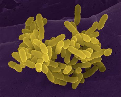 Proteus Mirabilis Photograph By Dennis Kunkel Microscopyscience Photo