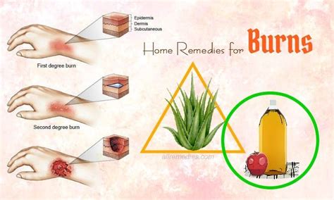 Blisters on the feet can result from shoes that are either too tight or rub the skin in one particular area. 30 Best Natural Home Remedies for Burns on Fingers, Face ...