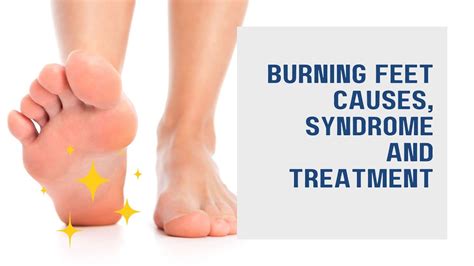 Burning Feet Causes Syndrome And Treatment Youtube