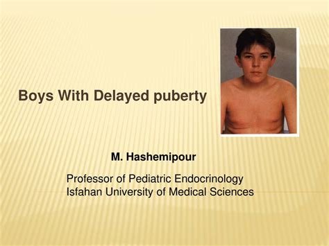 Ppt Boys With Delayed Puberty Powerpoint Presentation Free Download