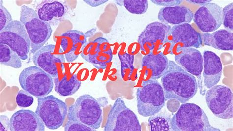 Diagnostic Workup For Acute Myeloid Leukemia Basics Youtube