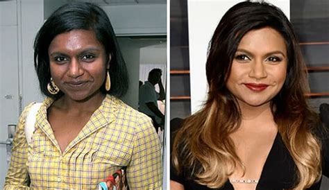 Mindy Kaling Plastic Surgery Rumors Compare Before And After Pictures