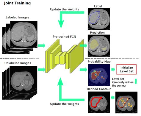Interactive Medical Image Segmentation Using Deep Learning With Image