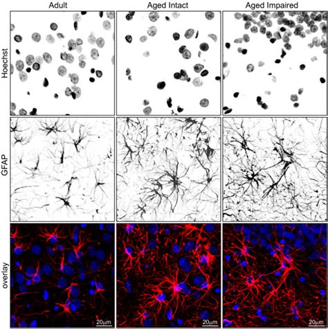 Morphological Characteristics Of Activated Astrocytes In Aged