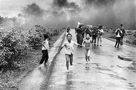 Napalm Girl At Center Of Iconic Vietnam War Photograph Undergoes Her