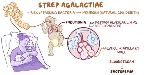 Streptococcus Agalactiae Group B Strep Usmle Flashcards Memorang Streptococcus