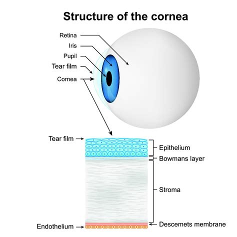 Cornea Eye Patient