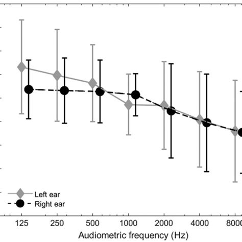 Average Audiograms For The Left And Right Ears Of The Study