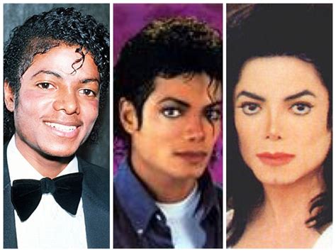 Before And After Celebrities With Vitiligo~introduction ~chapter 1