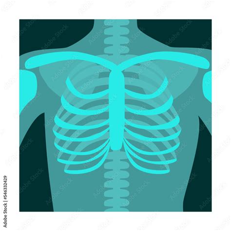 Ray Of Human Chest Front View Vector Illustration Bones Of Skeleton