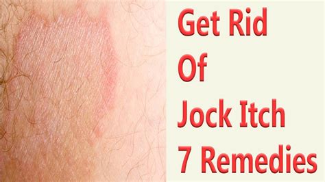7 Remedies To Cure Jock Itch How To Get Rid Of Jock Itch Youtube