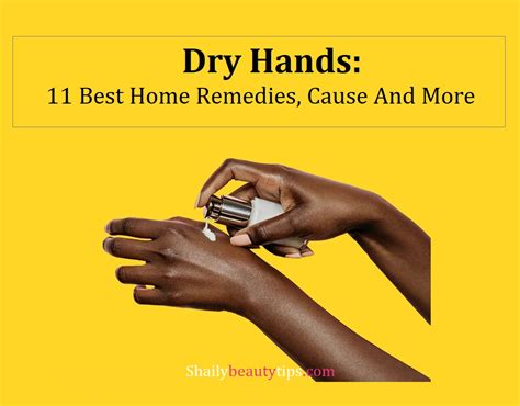 Dry Hands 11 Best Home Remedies Cause And More