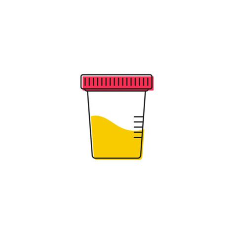 Urine Sample Illustrations Royalty Free Vector Graphics And Clip Art