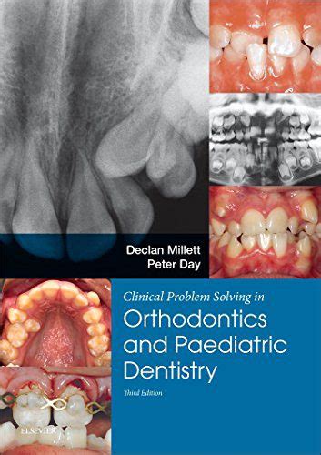 Clinical Problem Solving In Dentistry Orthodontics And Paediatric