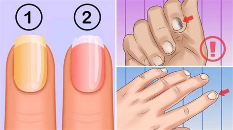 8 important signs your fingernails can tell about your health