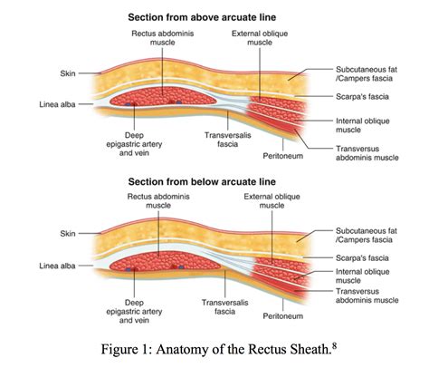 Emergency Medicine Educationsudden Abdominal Pain With A