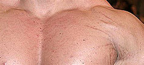 Stretch Marks | Big 5 Blog