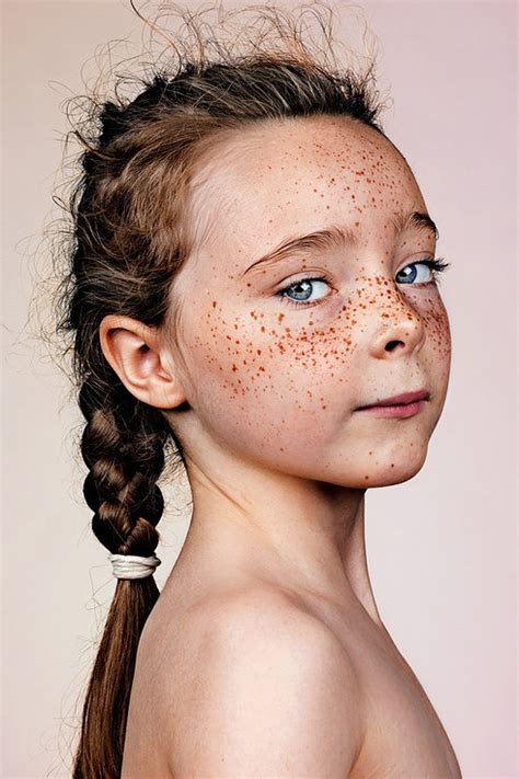 Why Do We Have Freckles On Our Face Frolicious Natural Hair Care