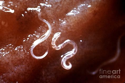 Dog Hookworm Photograph By Science Source
