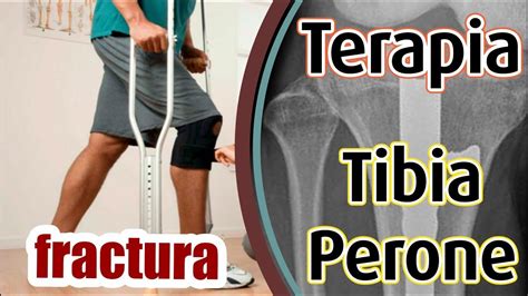 Como Dormir Con Fractura De Tibia Y Peroné Leapmoms