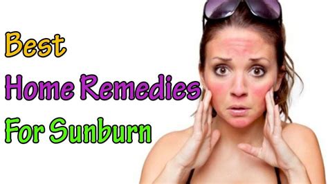Home Remedies For Sunburn How To Get Rid Of Sunburn Beauty Tips