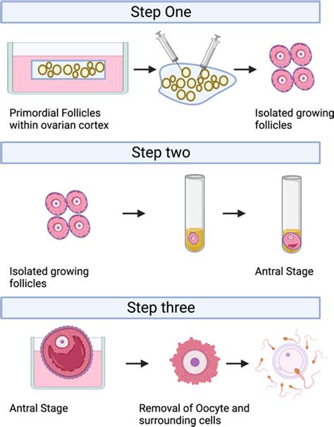 Frontiers Prospects For Fertility Preservation The Ovarian Organ Function Reconstruction