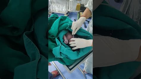Neonatal Resuscitation In Caesarean Section Under Spinal Anaesthesia