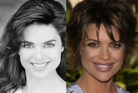 Lisa Rinna Please Stop With Plastic Surgery The Makeup Girl