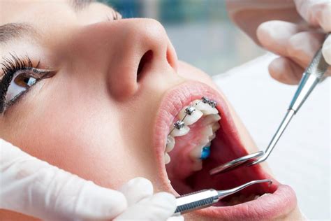 Leczenie Ortodontyczne Jak To Rzeczywi Cie Jest Dent Krak W