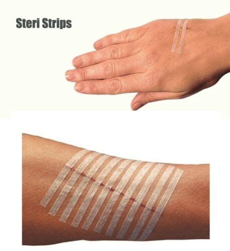 Wound Closure Tape Skin Adhesive Strips For Wounds