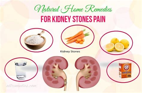 43 Natural Home Remedies For Kidney Stones Pain