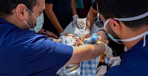 Riyadh Hospital Performs Separation Surgery On Syrian Conjoined Twins World Today News